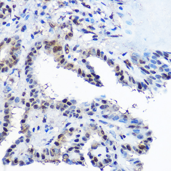 Casein Kinase 2 beta (CSNK2B) Rabbit polyclonal antibody