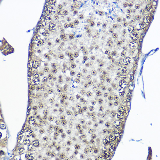 Casein Kinase 2 beta (CSNK2B) Rabbit polyclonal antibody