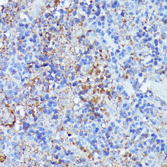 Septin 1 Rabbit polyclonal antibody