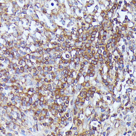 Septin 1 Rabbit polyclonal antibody