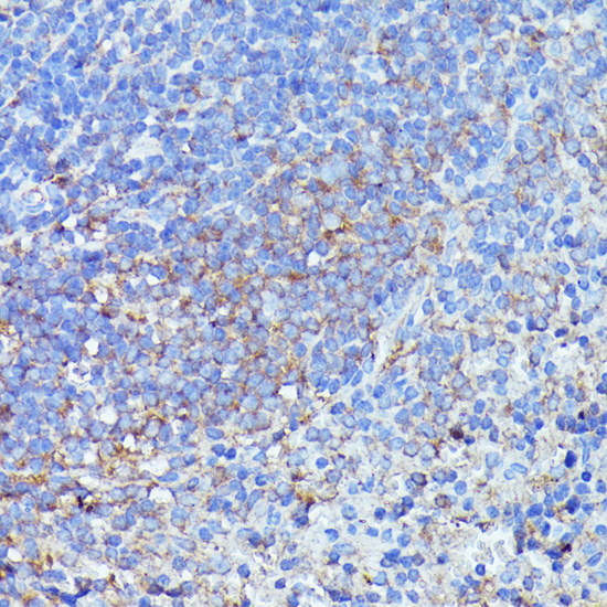 Septin 1 Rabbit polyclonal antibody