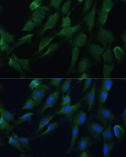 DRG2 Rabbit polyclonal antibody