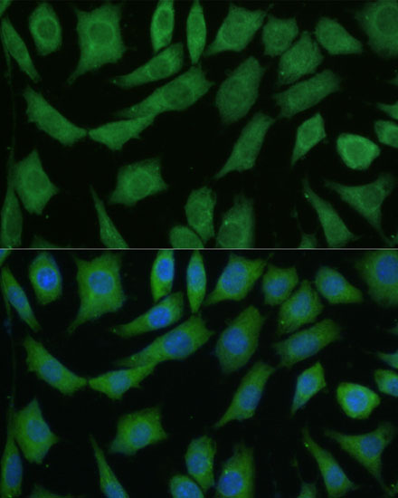 DRG2 Rabbit polyclonal antibody