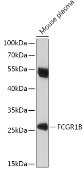 FCGR1B Rabbit polyclonal antibody