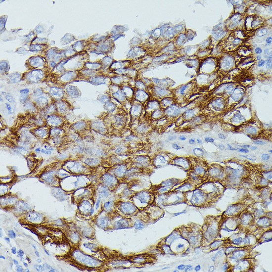 FCGR1B Rabbit polyclonal antibody