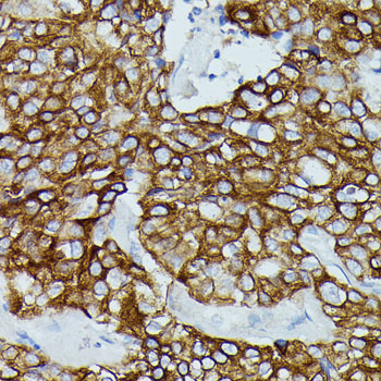 FCGR1B Rabbit polyclonal antibody