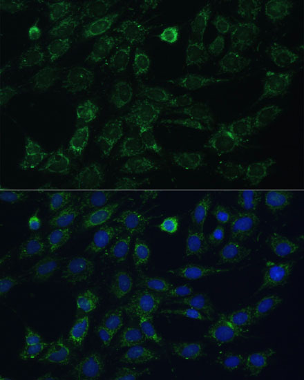 GK2 Rabbit polyclonal antibody