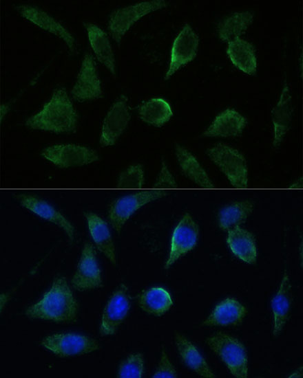 GK2 Rabbit polyclonal antibody
