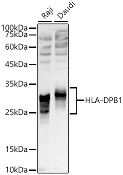 HLA-DPB1 Rabbit polyclonal antibody