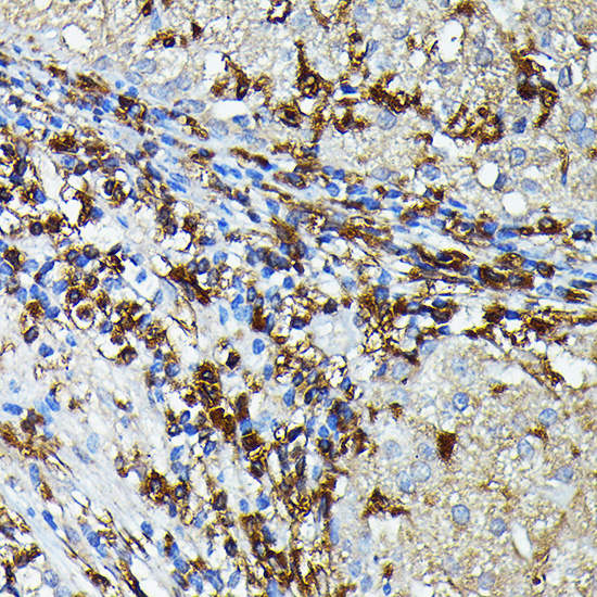 HLA-DPB1 Rabbit polyclonal antibody