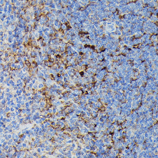 HLA-DPB1 Rabbit polyclonal antibody