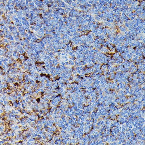 HLA-DPB1 Rabbit polyclonal antibody
