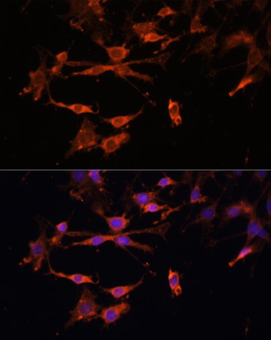 HLA-DPB1 Rabbit polyclonal antibody