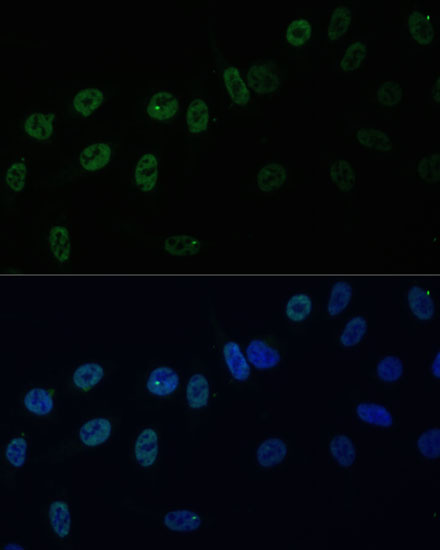 HNRPAB Rabbit polyclonal antibody