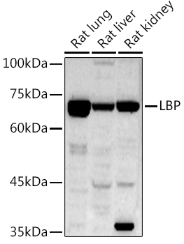 LBP Rabbit polyclonal antibody