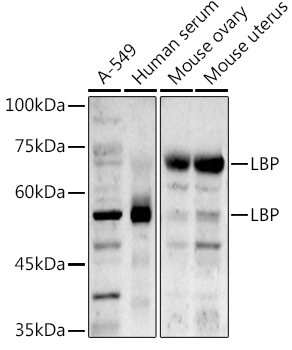 LBP Rabbit polyclonal antibody