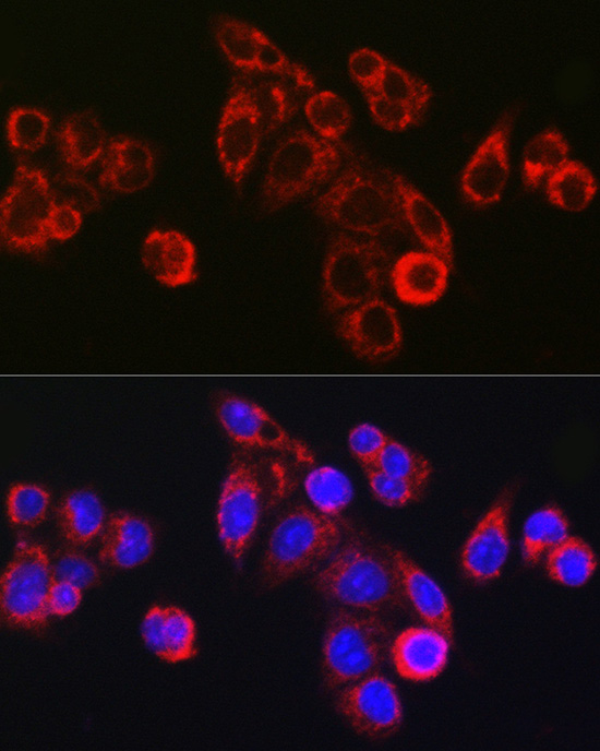 LBP Rabbit polyclonal antibody