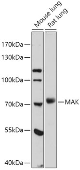 MAK Rabbit polyclonal antibody