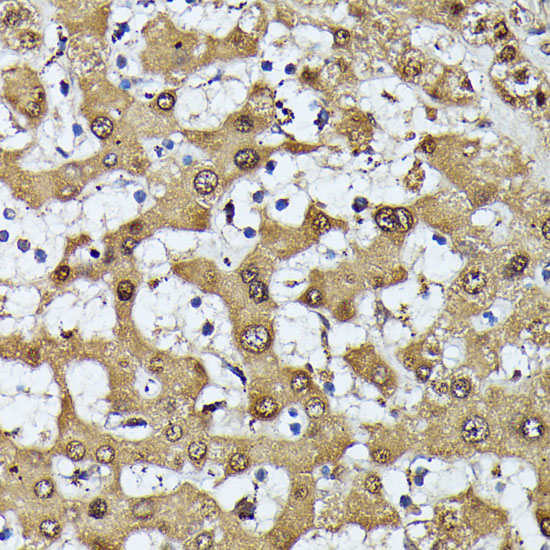 MAK Rabbit polyclonal antibody
