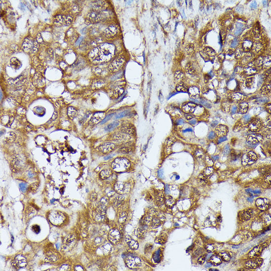 MAK Rabbit polyclonal antibody