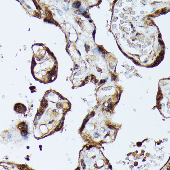 MAK Rabbit polyclonal antibody