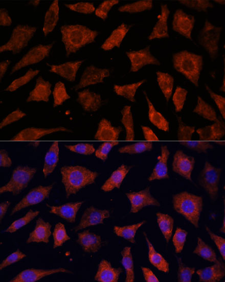 PDE6G Rabbit polyclonal antibody