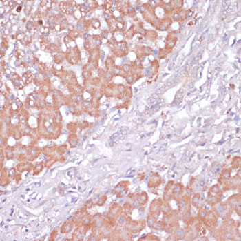 PI3 Kinase p85 beta Rabbit polyclonal antibody