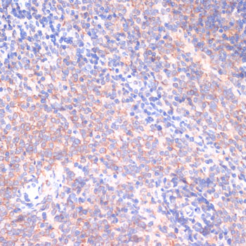 PI3 Kinase p85 beta Rabbit polyclonal antibody