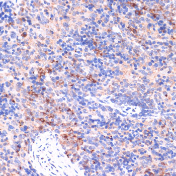 PI3 Kinase p85 beta Rabbit polyclonal antibody