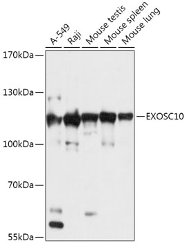 EXOSC10 Rabbit polyclonal antibody
