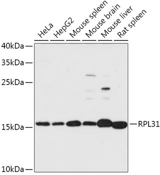 RPL31 Rabbit polyclonal antibody