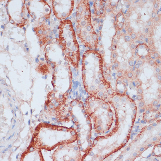 RPL31 Rabbit polyclonal antibody