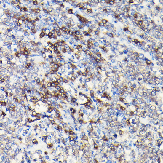 CD3E Rabbit polyclonal antibody