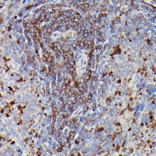 CD3E Rabbit polyclonal antibody