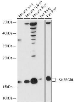 SH3BGRL Rabbit polyclonal antibody