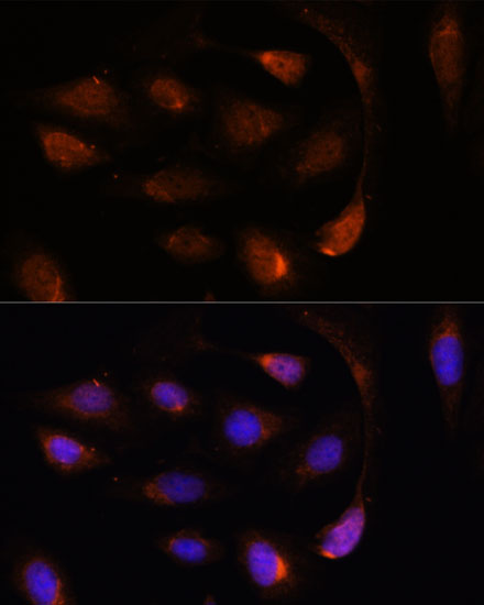 SH3BGRL Rabbit polyclonal antibody