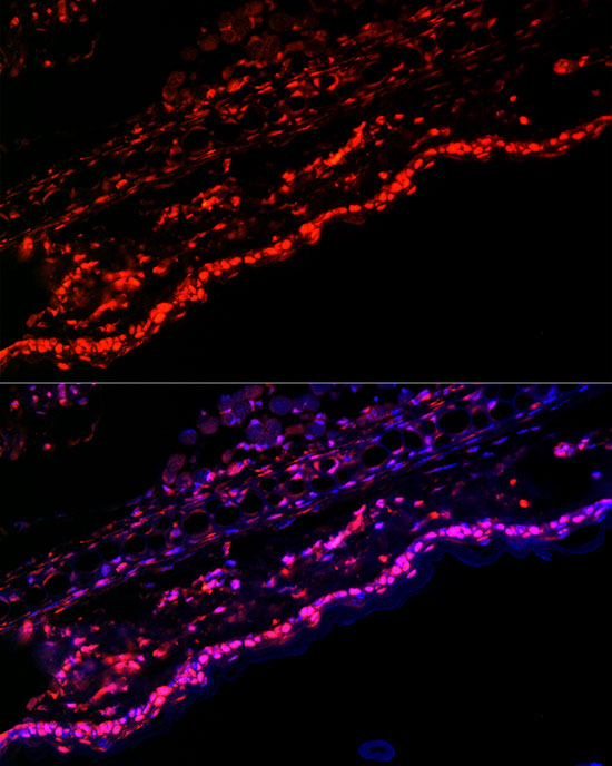 SPRR1A Rabbit polyclonal antibody