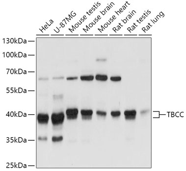 TBCC Rabbit polyclonal antibody
