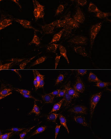 TBCC Rabbit polyclonal antibody