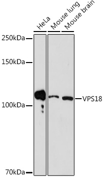 VPS18 Rabbit monoclonal antibody