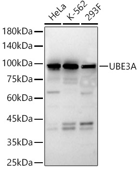 UBE3A Rabbit polyclonal antibody