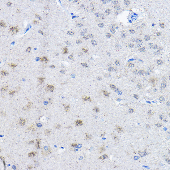 UBE3A Rabbit polyclonal antibody