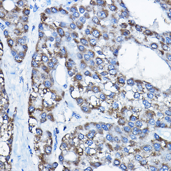 UBE3A Rabbit polyclonal antibody