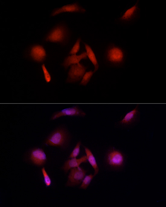 UBE3A Rabbit polyclonal antibody