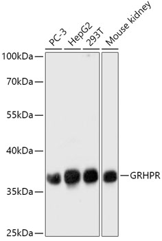 GRHPR Rabbit polyclonal antibody