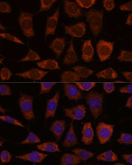 GRHPR Rabbit polyclonal antibody