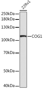 COG1 Rabbit polyclonal antibody