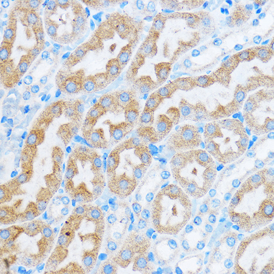 COG1 Rabbit polyclonal antibody