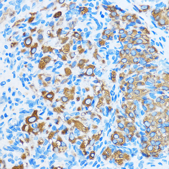 COG1 Rabbit polyclonal antibody