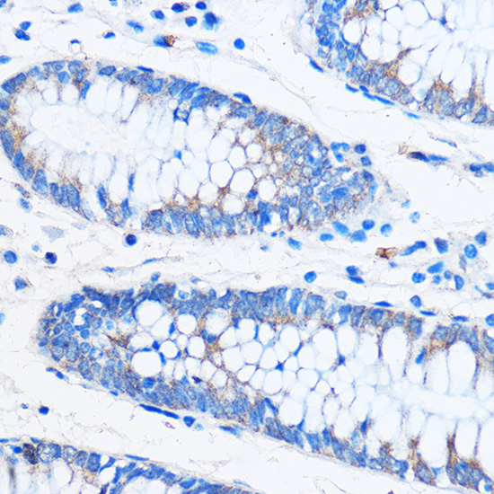 COG1 Rabbit polyclonal antibody